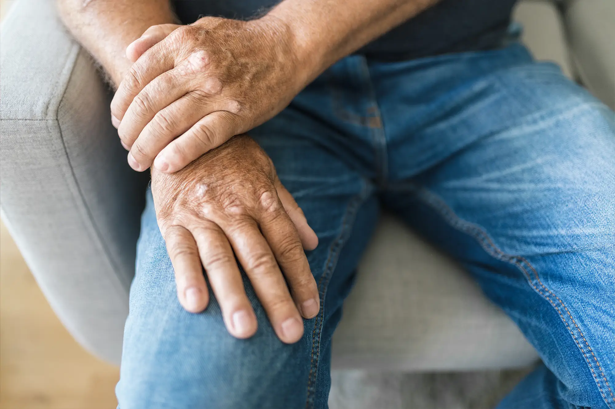 Arthritis treatment